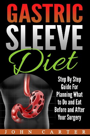 Cover: Gastric Sleeve Diet: Step By Step Guide For Planning What to Do and Eat Before and After Your Surgery - Carter, John