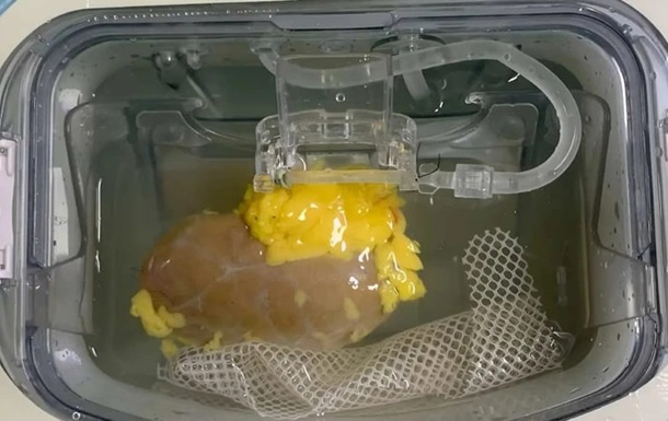 Ученые впервые создали «универсальную» почку для трансплантации