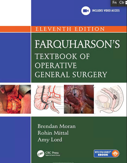 [Obrazek: ad494801b7dcbb6a507580cf0fce3a32.png]