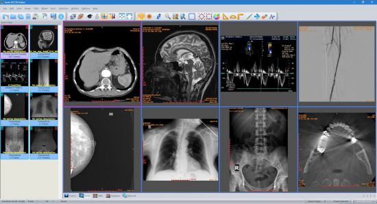 Sante DICOM Editor 10.3