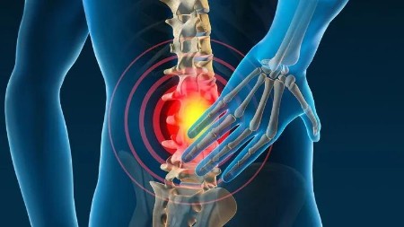 Freedom from Back Pain: Understand, Correct, Prevent