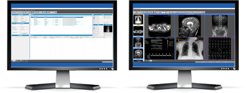 [Obrazek: 0330ecb832b58ad606c42e5134dec078.png]