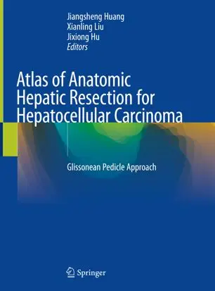 Atlas of Anatomic Hepatic Resection for Hepatocellular Carcinoma Glissonean Pedicle Approach (Repost)